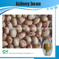 Organische Kultivierung Typ Lange Form Licht Speckled Kidney Bohnen Verkauf, Bulk Verpackung alle Arten von Nieren Bohnen Exporte